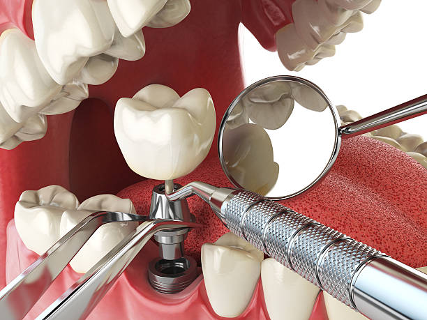 Best Emergency Treatment for Jaw Pain or Injury in Fort Lewis, WA